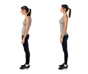Woman demonstrating poor posture and good posture
