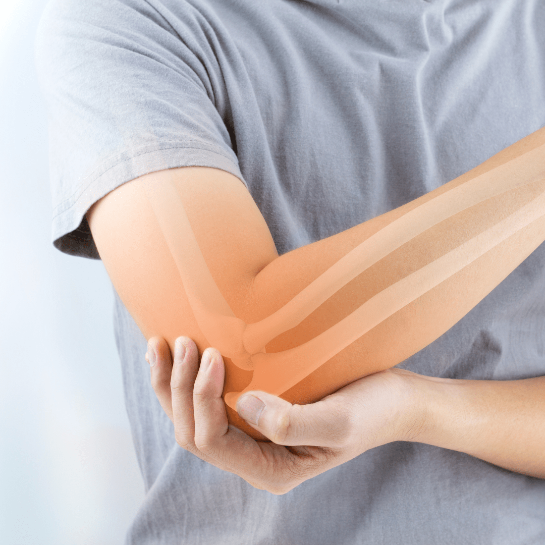 hand cupping elbow