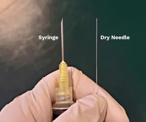 dry needling needle